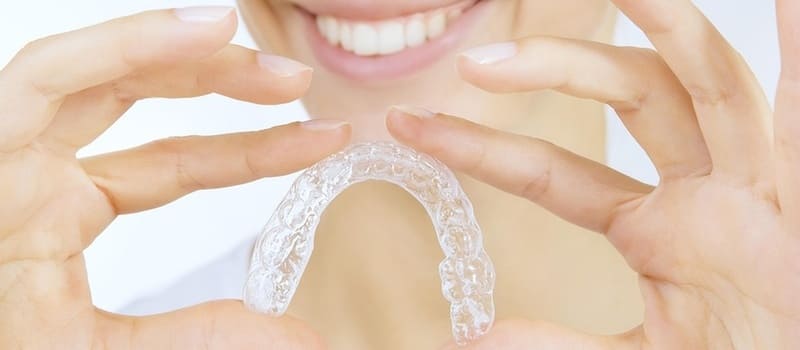 clear retainers pros and cons